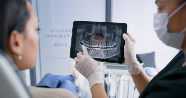 Licensed Tooth Extraction service in Branchville, SC - Smile Center Dentistry
